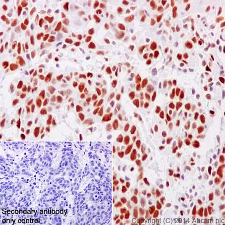 Immunohistochemistry (Formalin/PFA-fixed paraffin-embedded sections) - Anti-NFIB / NF1B2 + NFIC/CTF antibody [EPR14504] (AB200829)