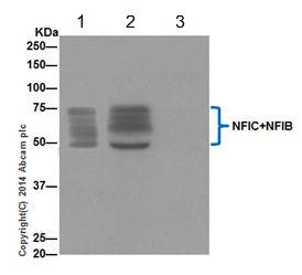 Immunoprecipitation - Anti-NFIB / NF1B2 + NFIC/CTF antibody [EPR14504] (AB200829), expandable thumbnail