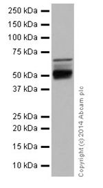 Western blot - Anti-NFIB / NF1B2 + NFIC/CTF antibody [EPR14504] (ab200829), expandable thumbnail