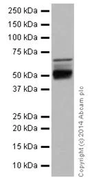 Western blot - Anti-NFIB / NF1B2 + NFIC/CTF antibody [EPR14504] (AB200829)