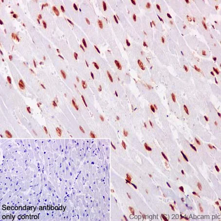 Immunohistochemistry (Formalin/PFA-fixed paraffin-embedded sections) - Anti-NFIB / NF1B2 + NFIC/CTF antibody [EPR14504] - BSA and Azide free (AB251321)