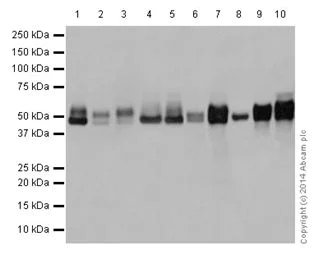 Western blot - Anti-NFIB / NF1B2 + NFIC/CTF antibody [EPR14504] - BSA and Azide free (AB251321)