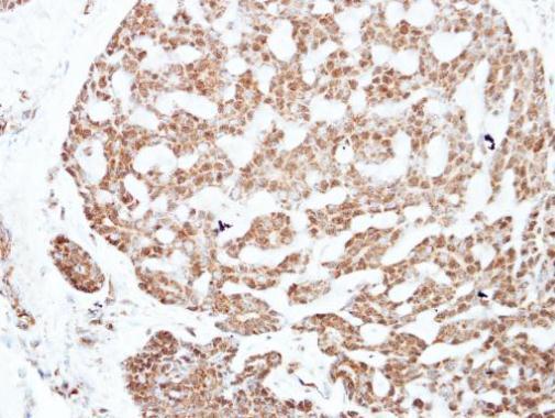 Immunohistochemistry (Formalin/PFA-fixed paraffin-embedded sections) - Anti-NFIC/CTF antibody (AB228909)
