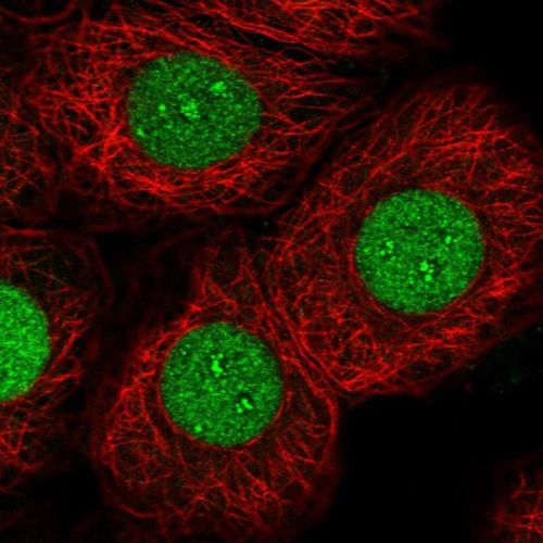 Immunocytochemistry/ Immunofluorescence - Anti-NFIC/CTF antibody (AB244496), expandable thumbnail