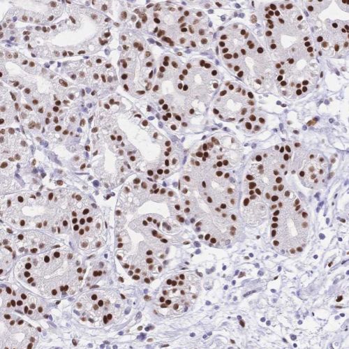 Immunohistochemistry (Formalin/PFA-fixed paraffin-embedded sections) - Anti-NFIC/CTF antibody (AB244496), expandable thumbnail