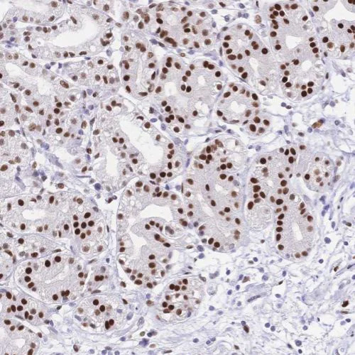 Immunohistochemistry (Formalin/PFA-fixed paraffin-embedded sections) - Anti-NFIC/CTF antibody (AB244496)