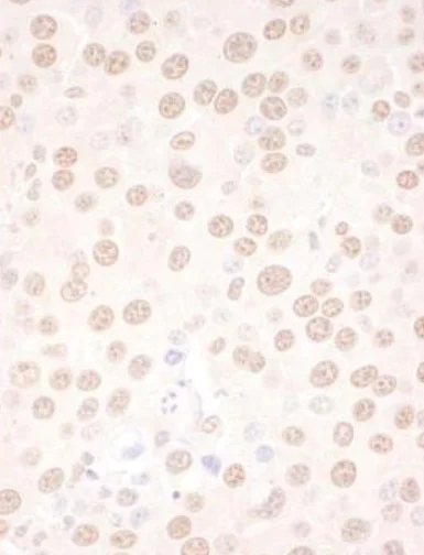 Immunohistochemistry (Formalin/PFA-fixed paraffin-embedded sections) - Anti-NFIC/CTF antibody (AB245597)