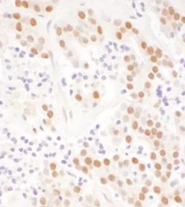 Immunohistochemistry (Formalin/PFA-fixed paraffin-embedded sections) - Anti-NFIC/CTF antibody (AB245597)