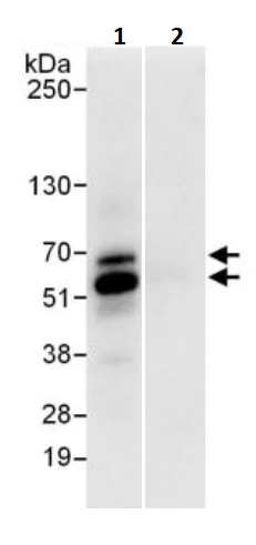 Immunoprecipitation - Anti-NFIC/CTF antibody (AB245597)