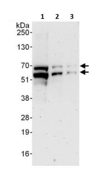 Western blot - Anti-NFIC/CTF antibody (AB245597)