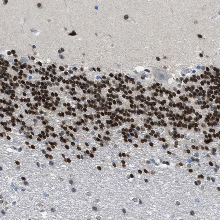 Immunohistochemistry (Formalin/PFA-fixed paraffin-embedded sections) - Anti-NFIX Antibody (AB327186)