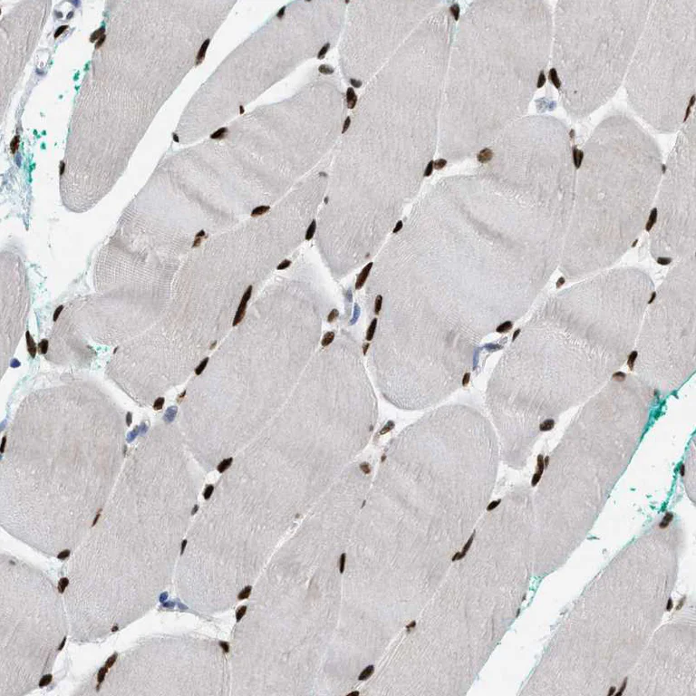 Immunohistochemistry (Formalin/PFA-fixed paraffin-embedded sections) - Anti-NFIX Antibody (AB327186)