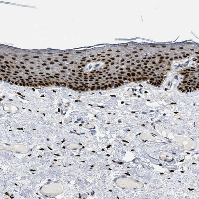 Immunohistochemistry (Formalin/PFA-fixed paraffin-embedded sections) - Anti-NFIX Antibody (AB327186)