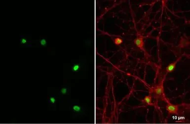 Immunocytochemistry/ Immunofluorescence - Anti-NFIX/CTF antibody [HL1269] - BSA and Azide free (AB313840)