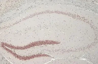 Immunohistochemistry (Formalin/PFA-fixed paraffin-embedded sections) - Anti-NFIX/CTF antibody [HL1269] - BSA and Azide free (AB313840)