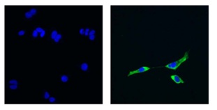 Immunocytochemistry/ Immunofluorescence - Anti-NFkB Inducing Kinase NIK antibody [3H31L48] (AB203568), expandable thumbnail