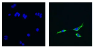 Immunocytochemistry/ Immunofluorescence - Anti-NFkB Inducing Kinase NIK antibody [3H31L48] (AB203568)