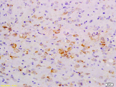 Immunohistochemistry (Formalin/PFA-fixed paraffin-embedded sections) - Anti-NFkB Inducing Kinase NIK antibody (AB216409)