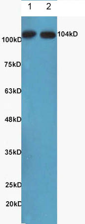 Western blot - Anti-NFkB Inducing Kinase NIK antibody (AB216409), expandable thumbnail