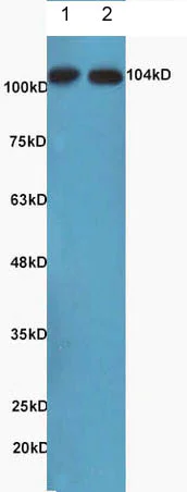 Western blot - Anti-NFkB Inducing Kinase NIK antibody (AB216409)