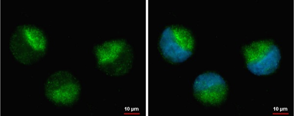 Immunocytochemistry/ Immunofluorescence - Anti-NFkB Inducing Kinase NIK antibody (AB228587)