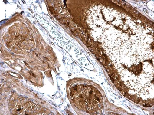 Immunohistochemistry (Formalin/PFA-fixed paraffin-embedded sections) - Anti-NFkB Inducing Kinase NIK antibody (AB228587)