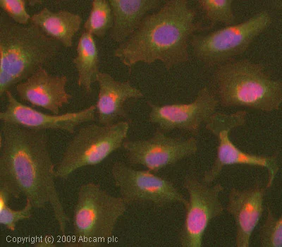 Immunocytochemistry/ Immunofluorescence - Anti-NFkB Inducing Kinase NIK antibody (AB7204)