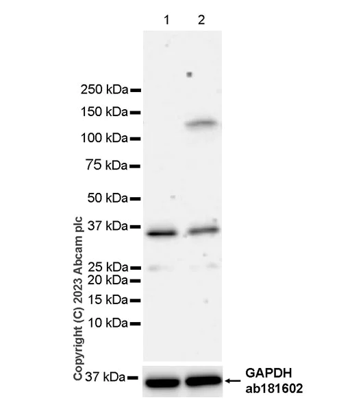 Western blot - Anti-NFkB Inducing Kinase NIK antibody [EPR26101-23] - BSA and Azide free (AB314147)