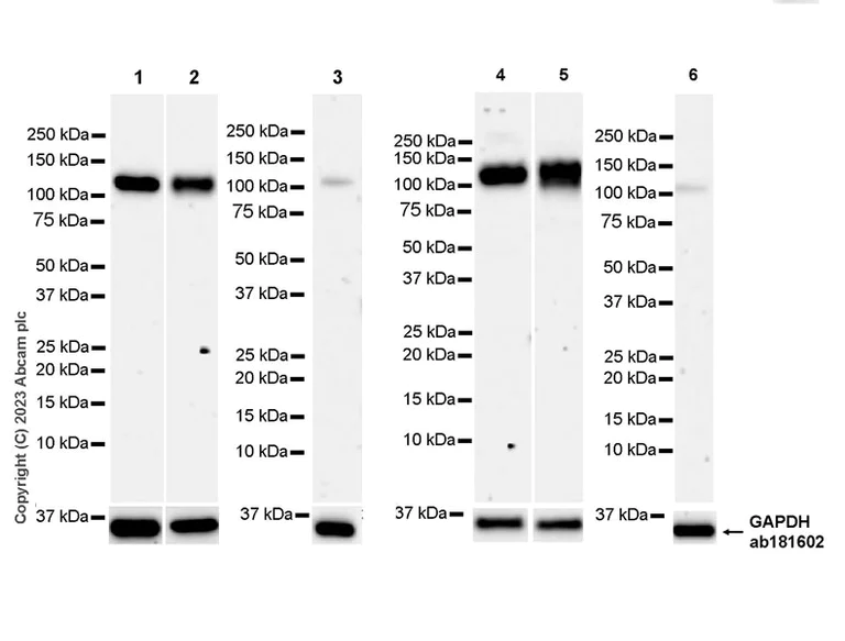 Western blot - Anti-NFkB Inducing Kinase NIK antibody [EPR26101-23] - BSA and Azide free (AB314147)