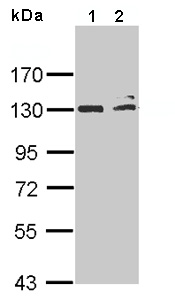 Western blot - Anti-NFkB Inducing Kinase NIK antibody - N-terminal (AB137671), expandable thumbnail