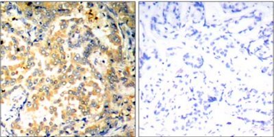 Immunohistochemistry (Formalin/PFA-fixed paraffin-embedded sections) - Anti-NFkB p100/NFKB2 antibody (AB131539), expandable thumbnail