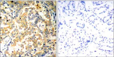 Immunohistochemistry (Formalin/PFA-fixed paraffin-embedded sections) - Anti-NFkB p100/NFKB2 antibody (AB131539)