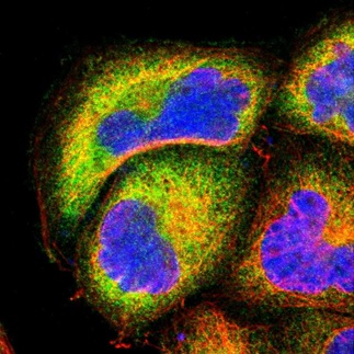 Immunocytochemistry/ Immunofluorescence - Anti-NFkB p100/NFKB2 antibody (AB209799), expandable thumbnail