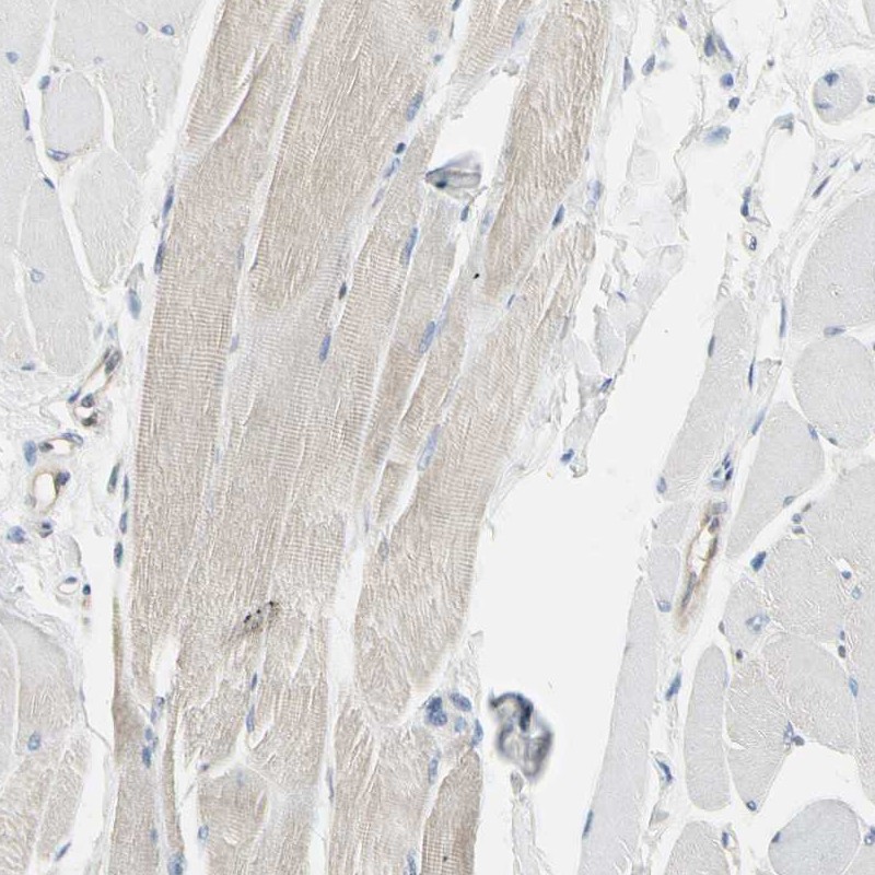 Immunohistochemistry (Formalin/PFA-fixed paraffin-embedded sections) - Anti-NFkB p100/NFKB2 antibody (ab209799), expandable thumbnail
