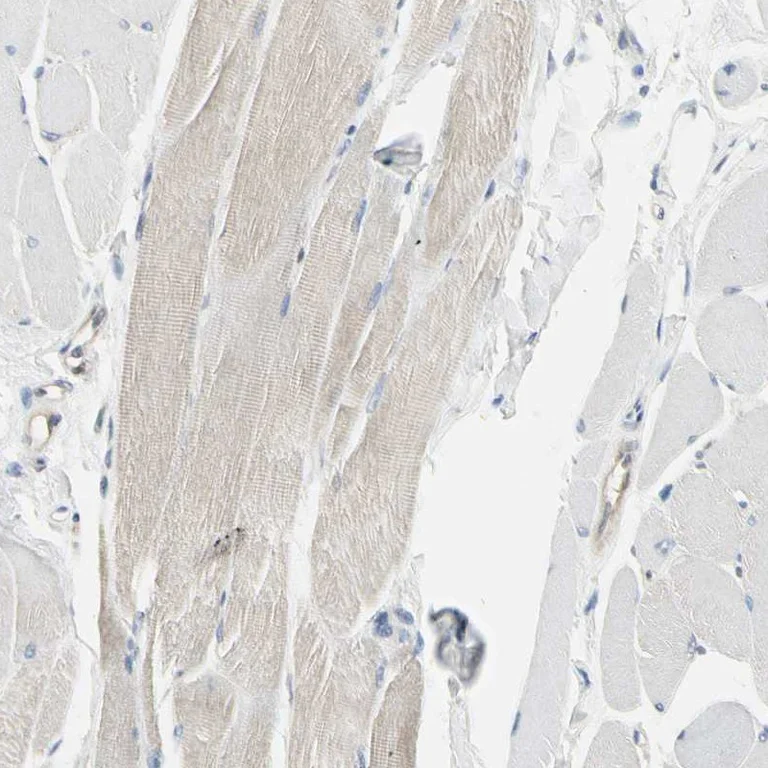 Immunohistochemistry (Formalin/PFA-fixed paraffin-embedded sections) - Anti-NFkB p100/NFKB2 antibody (AB209799)