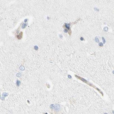 Immunohistochemistry (Formalin/PFA-fixed paraffin-embedded sections) - Anti-NFkB p100/NFKB2 antibody (ab209799), expandable thumbnail