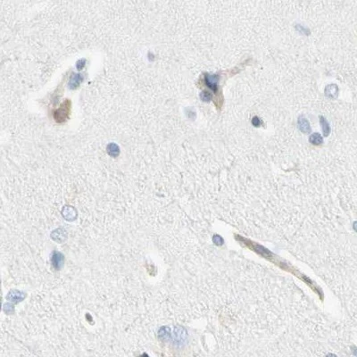 Immunohistochemistry (Formalin/PFA-fixed paraffin-embedded sections) - Anti-NFkB p100/NFKB2 antibody (AB209799)