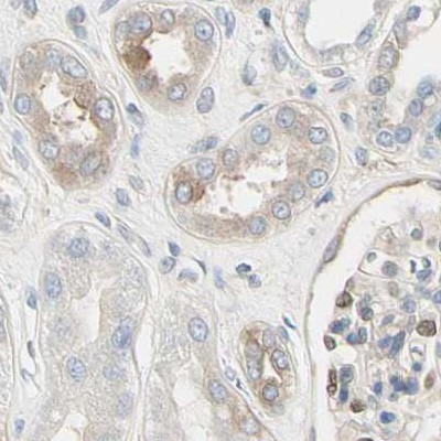 Immunohistochemistry (Formalin/PFA-fixed paraffin-embedded sections) - Anti-NFkB p100/NFKB2 antibody (ab209799), expandable thumbnail