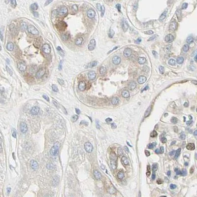 Immunohistochemistry (Formalin/PFA-fixed paraffin-embedded sections) - Anti-NFkB p100/NFKB2 antibody (AB209799)