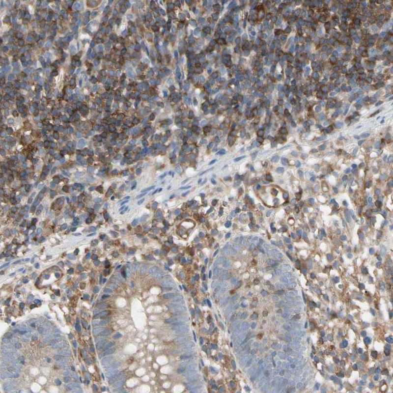 Immunohistochemistry (Formalin/PFA-fixed paraffin-embedded sections) - Anti-NFkB p100/NFKB2 antibody (AB209799), expandable thumbnail