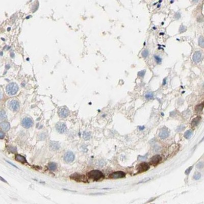 Immunohistochemistry (Formalin/PFA-fixed paraffin-embedded sections) - Anti-NFkB p100/NFKB2 antibody (AB209799), expandable thumbnail