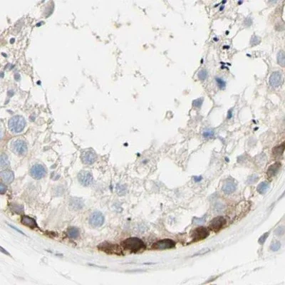 Immunohistochemistry (Formalin/PFA-fixed paraffin-embedded sections) - Anti-NFkB p100/NFKB2 antibody (AB209799)