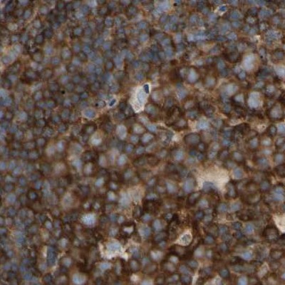 Immunohistochemistry (Formalin/PFA-fixed paraffin-embedded sections) - Anti-NFkB p100/NFKB2 antibody (AB209799), expandable thumbnail
