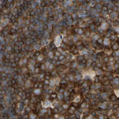 Immunohistochemistry (Formalin/PFA-fixed paraffin-embedded sections) - Anti-NFkB p100/NFKB2 antibody (AB209799)