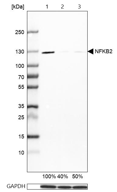 Western blot - Anti-NFkB p100/NFKB2 antibody (AB209799), expandable thumbnail
