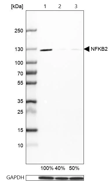 Western blot - Anti-NFkB p100/NFKB2 antibody (AB209799)