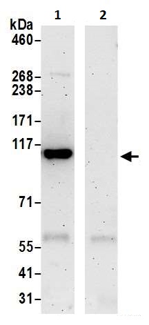 Immunoprecipitation - Anti-NFkB p100/NFKB2 antibody (AB264236), expandable thumbnail