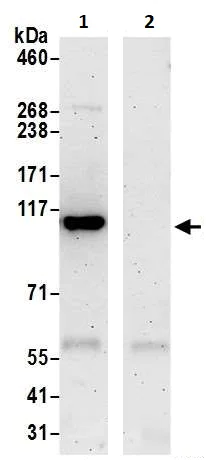 Immunoprecipitation - Anti-NFkB p100/NFKB2 antibody (AB264236)