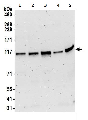 Western blot - Anti-NFkB p100/NFKB2 antibody (AB264236), expandable thumbnail