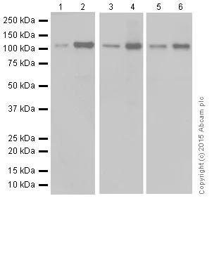 Western blot - Anti-NFkB p100/NFKB2 antibody [EPR18756] (AB191594)